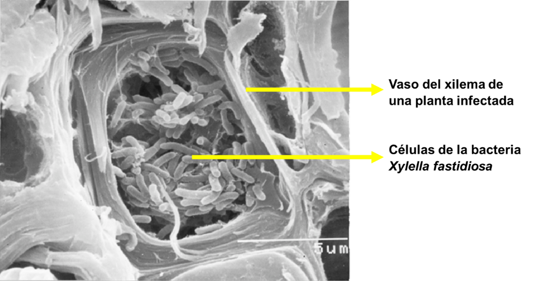 vaso-del-xilema-con-celulas-de-Xylella-fastidiosa.png
