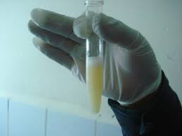 semen-1.jpg semen-1.jpg