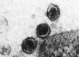 Virus PPC